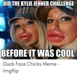 🇲 🇽 25+ Best Memes About Kylie Before and After Memes Kylie 