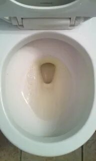 File:Human Urine in Toilet Bowl.jpg - Wikimedia Commons