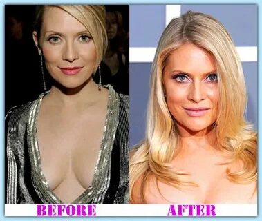 Emily Procter Plastic Surgery before and after Emily Procter