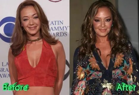 Leah Remini Before and After Plastic Surgery Leah remini, Pl