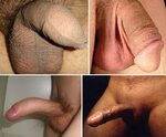 Naked Circumcised Penis Photos - nomadteafestival.eu