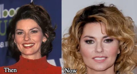 Shania Twain Plastic Surgery Before and After Photos - Lates