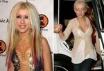 Christina Aguilera Plastic Surgery - Boob Job Before & After