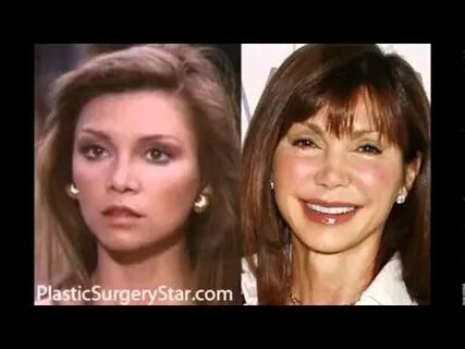 Nancy Pelosi plastic surgery before and after photos - YouTu