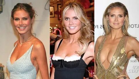 Heidi Klum Plastic Surgery Before and After Pictures 2022