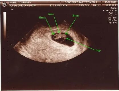 My First Ultrasound!!! I was 7 weeks and 5 days when I had. 
