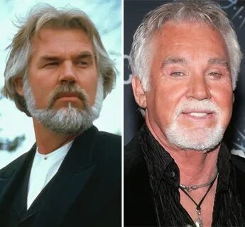 Kenny Rogers Plastic Surgery