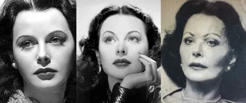 Hedy lamarr plastic surgery - Plastic Surgery