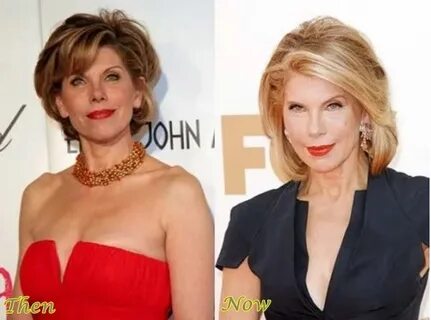 Christine Jane Baranski Plastic Surgery Bad Plastic Surgery