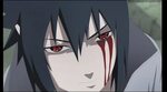 Sasuke Bleeding Eye