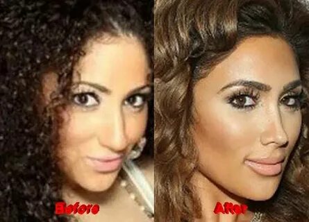 Nikki Lhhh Before Surgery / Nikki Baby Before Plastic Surger