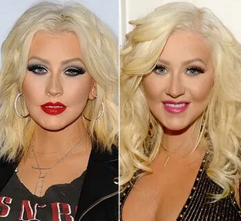 Christina Aguilera: Plastic Surgery On Face? - See Before & 