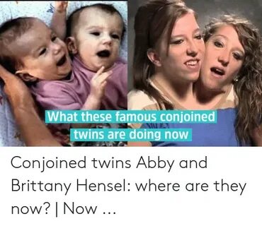 🇲 🇽 25+ Best Memes About Conjoined Twins Abby and Brittany C