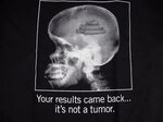 Your results came back...Its Not A Tumor T-Shirt