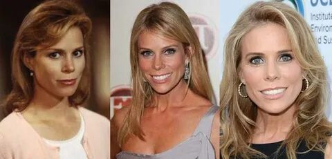 Cheryl Hines Plastic Surgery Before and After Pictures 2022