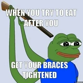 Pin on Braces