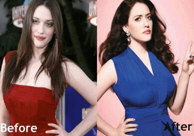 Kat Dennings Plastic Surgery: Before After Boob Job Pictures