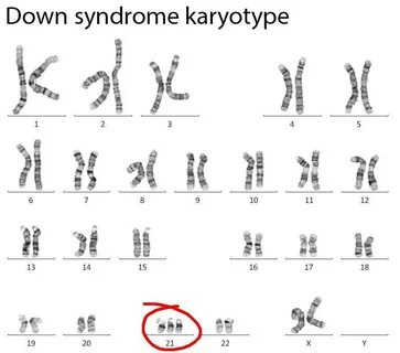 30 Biology Karyotype Worksheet Answers Key Education Templat