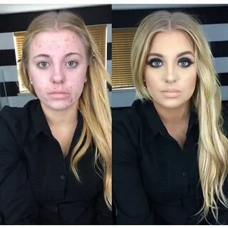 @makeupbydreigh on Instagram: "My regular ❤" Bad acne, Makeu