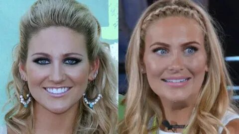 Stephanie Pratt plastic surgery before and after - Plastic s