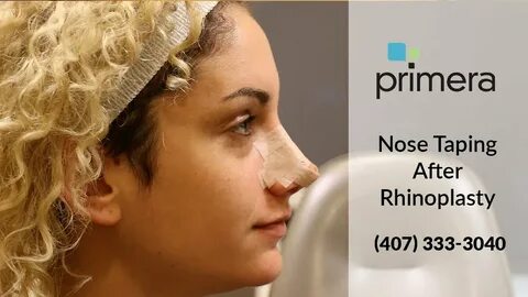 How To Tape Your Nose After Rhinoplasty (Nose Job) Orlando P