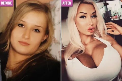 Model reveals her exes paid for £ 50k surgery including thre