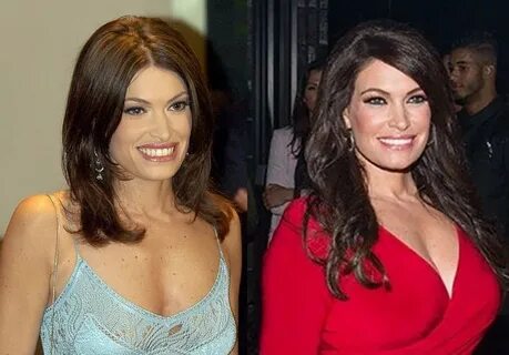 Kimberly Guilfoyle before and after plastic surgery Celebrit