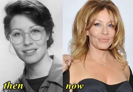 Linda Kozlowski Plastic Surgery Before and After - Plastic S