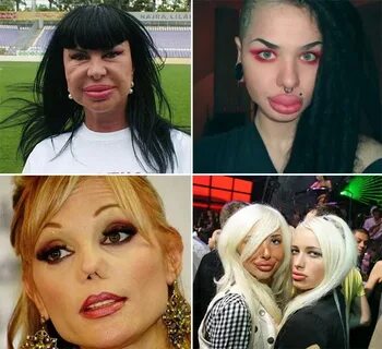 Plastic Surgery Gone Wrong