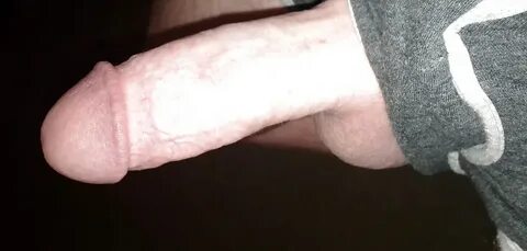 Cyst Removal From Ball Sack Free Porn