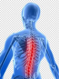 Free download Spinal cord illustration, Back pain Vertebral 