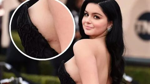 Ariel Winter nie zamaskowała blizn po operacji zmniejszenia 