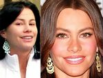 Sofia Vergara Before And After Nose Job Reference