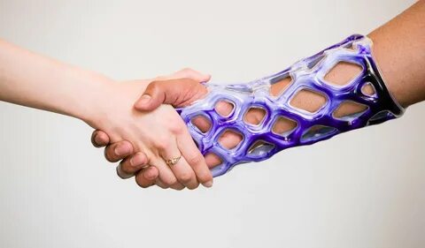 Revolutionary New Arm Cast is Waterproof, Breathable, and It