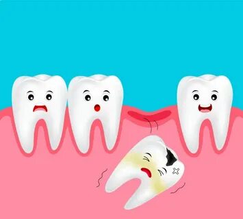 Gingivitis Teeth Cartoon Сток видеоклипы - iStock