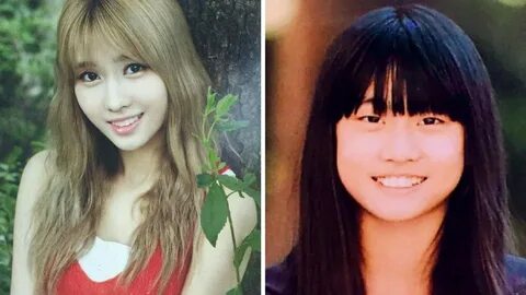 View Kpop Idols Before And After Plastic Surgery Background 