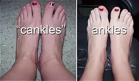 Define Your Ankles & Get RID of Cankles with the FasciaBlast