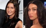 Bella Hadid Plastic surgery and modeling Lip implants, Nose 