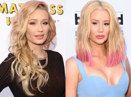 Botched Is Almost Back! See Iggy Azalea, Ashlee Simpson and 