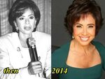 Jeanine Pirro Plastic Surgery Before and After - Plastic Sur