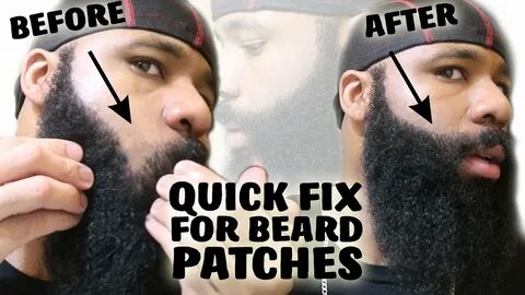 Quick Fix For A Patchy Beard Growing A Thick Mustache For No