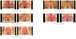 Methods to tighten vagina - Auraj.eu