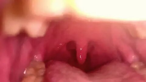 My uvula Inside my mouth - YouTube