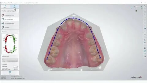 3Shape Ortho Analyzer - How to Make a Dental Arch - YouTube