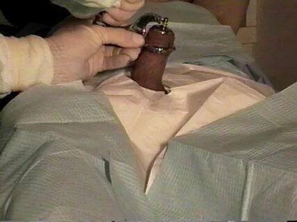 Хирургическая процедура обрезания - Freeimg.wiki