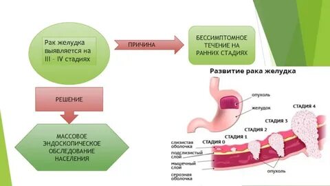Диагностика рака желудка презентация, доклад