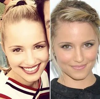 nose plastic surgery Did Dianna Agron Get Plastic Surgery? 5
