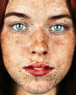 Все посты по тегу "freckles"