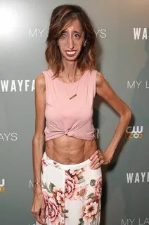 Lizzie Velasquez Shares Her Best Advice for Standing Up to B