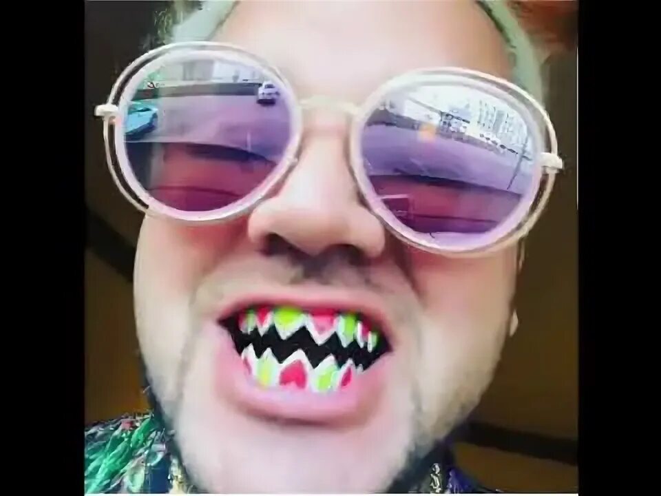 Riff raff Has diamond tri-color Fang Teeth Giving Him A New 